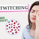 Eye Twitching Vitamin Deficiency