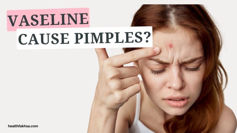 Will Vaseline Cause Pimples