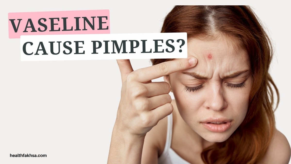 Will Vaseline Cause Pimples